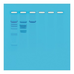 DNA의 제한효소 분석