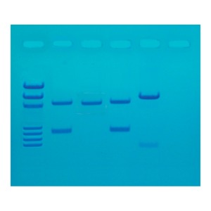 PCR증폭에 의한 DNA 지문분석