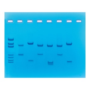 제한효소에 의한 DNA 지문분석