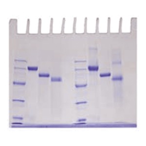생명과학 - 1. 전기영동 Pcr 등 실험키트 > 제품목록” style=”width:100%” title=”생명과학 – 1. 전기영동 PCR 등 실험키트 > 제품목록”><figcaption>생명과학 – 1. 전기영동 Pcr 등 실험키트 > 제품목록</figcaption></figure>
<figure><img decoding=