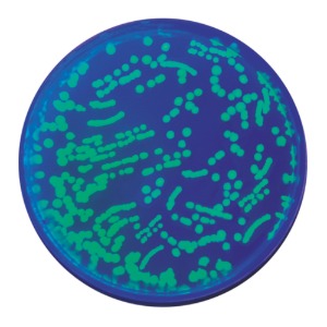 형질전환 실험세트3 (GFP를 이용한 박테리아의 형질전환 및 단백질 정제)