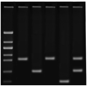 RT-PCR을 이용한 코로나모의진단
