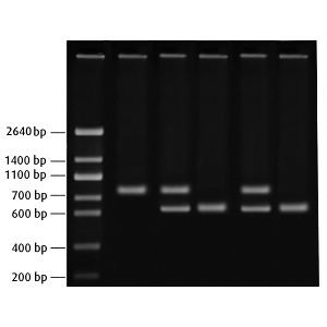 PCR을 이용한 헌팅턴병 연구